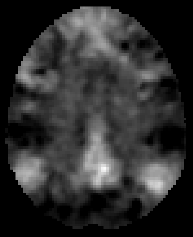 A creepy face in a fMRI scan.